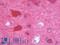 Microtubule-associated protein RP/EB family member 2 antibody, LS-B9959, Lifespan Biosciences, Immunohistochemistry paraffin image 