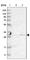 Thiopurine S-Methyltransferase antibody, HPA019851, Atlas Antibodies, Western Blot image 