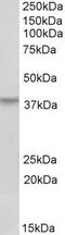 Tribbles Pseudokinase 1 antibody, 43-385, ProSci, Western Blot image 