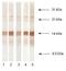 Procalcitonin antibody, NB110-13042, Novus Biologicals, Western Blot image 