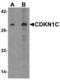 Cyclin Dependent Kinase Inhibitor 1C antibody, LS-B8859, Lifespan Biosciences, Western Blot image 