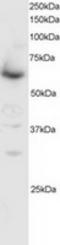 SMAD Family Member 4 antibody, TA302724, Origene, Western Blot image 