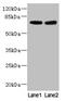 Polypeptide N-Acetylgalactosaminyltransferase 15 antibody, CSB-PA822698LA01HU, Cusabio, Western Blot image 