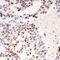 DNA Topoisomerase II Alpha antibody, LS-C368557, Lifespan Biosciences, Immunohistochemistry frozen image 