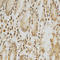Histone Deacetylase 6 antibody, abx125935, Abbexa, Immunohistochemistry paraffin image 