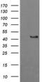 Gamma-Butyrobetaine Hydroxylase 1 antibody, NBP2-45548, Novus Biologicals, Western Blot image 