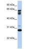 Transmembrane Protein 187 antibody, NBP1-69553, Novus Biologicals, Western Blot image 