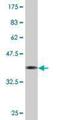 LDL Receptor Related Protein 3 antibody, H00004037-M10, Novus Biologicals, Western Blot image 