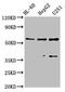 Ectonucleoside Triphosphate Diphosphohydrolase 1 antibody, CSB-PA007690LA01HU, Cusabio, Western Blot image 