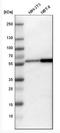 Protein Phosphatase 3 Catalytic Subunit Alpha antibody, NBP1-88218, Novus Biologicals, Western Blot image 