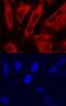 TYB4 antibody, AF6796, R&D Systems, Immunocytochemistry image 