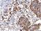 Serpin Family H Member 1 antibody, NBP2-16893, Novus Biologicals, Immunohistochemistry frozen image 