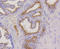 Keratin 17 antibody, STJ112837, St John