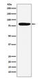 Coagulation Factor XIII A Chain antibody, M02047-1, Boster Biological Technology, Western Blot image 