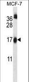 Ubiquitin Conjugating Enzyme E2 W antibody, LS-C160388, Lifespan Biosciences, Western Blot image 