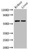 Aldehyde Dehydrogenase 6 Family Member A1 antibody, CSB-PA001578LA01HU, Cusabio, Western Blot image 