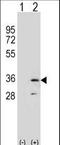 Replication Protein A2 antibody, LS-C162686, Lifespan Biosciences, Western Blot image 