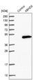 Abhydrolase Domain Containing 5 antibody, NBP1-84507, Novus Biologicals, Western Blot image 