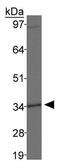 Distal-Less Homeobox 4 antibody, GTX30648, GeneTex, Western Blot image 