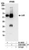Linker for activation of X cells antibody, A304-459A, Bethyl Labs, Immunoprecipitation image 