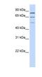 Zinc Finger Protein 699 antibody, NBP1-91376, Novus Biologicals, Western Blot image 