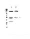 Glucokinase antibody, A00884-1, Boster Biological Technology, Western Blot image 