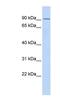 TCDD-inducible poly [ADP-ribose] polymerase antibody, NBP1-55363, Novus Biologicals, Western Blot image 