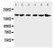 ALK Receptor Tyrosine Kinase antibody, PA1741, Boster Biological Technology, Western Blot image 