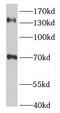 TSC Complex Subunit 1 antibody, FNab03751, FineTest, Western Blot image 