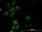 Prolyl 3-Hydroxylase 1 antibody, H00064175-M01, Novus Biologicals, Immunofluorescence image 
