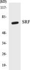 Serum Response Factor antibody, EKC1539, Boster Biological Technology, Western Blot image 