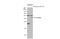 Interleukin 1 Beta antibody, GTX74034, GeneTex, Western Blot image 