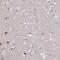 Acid Phosphatase 7, Tartrate Resistant (Putative) antibody, NBP2-48768, Novus Biologicals, Immunohistochemistry paraffin image 