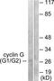 Cyclin G1 antibody, TA313571, Origene, Western Blot image 