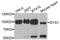 Glycogen Synthase 1 antibody, abx001960, Abbexa, Western Blot image 