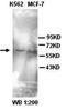 Amyloid Beta Precursor Protein Binding Family A Member 1 antibody, orb77102, Biorbyt, Western Blot image 