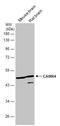 Calcium/Calmodulin Dependent Protein Kinase IV antibody, GTX106023, GeneTex, Western Blot image 