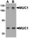 Mucin 1, Cell Surface Associated antibody, LS-B10124, Lifespan Biosciences, Western Blot image 
