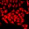 Chromatin assembly factor 1 subunit B antibody, LS-C668165, Lifespan Biosciences, Immunofluorescence image 