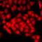 Chromatin Assembly Factor 1 Subunit B antibody, LS-C668165, Lifespan Biosciences, Immunofluorescence image 