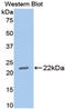 Matrix Metallopeptidase 13 antibody, LS-C304736, Lifespan Biosciences, Western Blot image 