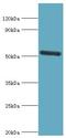 Interleukin 1 Receptor Associated Kinase 4 antibody, LS-C375972, Lifespan Biosciences, Western Blot image 