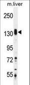 SAM And SH3 Domain Containing 1 antibody, LS-C162873, Lifespan Biosciences, Western Blot image 