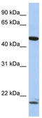 PLAG1 Like Zinc Finger 1 antibody, TA330319, Origene, Western Blot image 