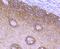 Keratin 5 antibody, NBP2-67027, Novus Biologicals, Immunohistochemistry paraffin image 