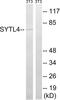 Synaptotagmin Like 4 antibody, abx014934, Abbexa, Western Blot image 