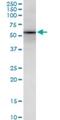 SRY-Box 18 antibody, H00054345-M05, Novus Biologicals, Western Blot image 