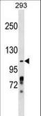 Zinc Finger And BTB Domain Containing 4 antibody, LS-C157392, Lifespan Biosciences, Western Blot image 