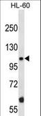 TAO Kinase 2 antibody, LS-C164587, Lifespan Biosciences, Western Blot image 