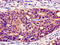 Perilipin 1 antibody, LS-C671441, Lifespan Biosciences, Immunohistochemistry paraffin image 